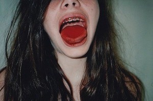 снять брекеты