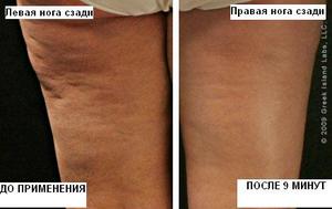 Adonia LegTone Serum