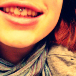 Smiley piercing