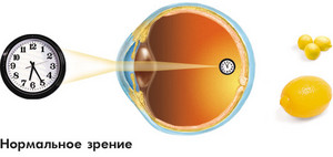 безоперационно восстановить зрение