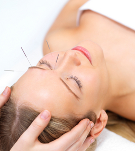 Cosmetic Acupuncture