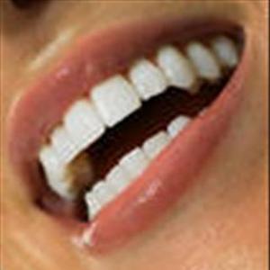 белоснежные зубы