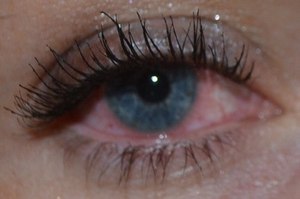 аллергию в пропасть