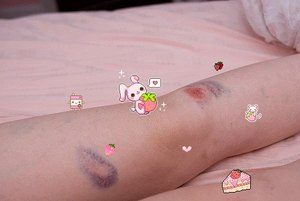 детские пластыри