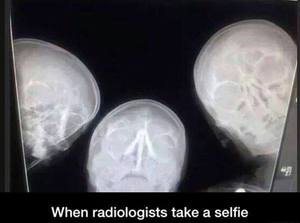 X-ray selfie