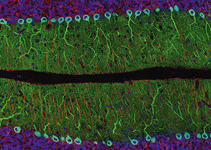 Постеры histology/pathology