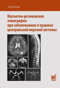 МАГНИТНО-РЕЗОНАНСНАЯ ТОМОГРАФИЯ ПРИ ЗАБОЛЕВАНИЯХ И ТРАВМАХ ЦЕНТРАЛЬНОЙ НЕРВНОЙ СИСТЕМЫ