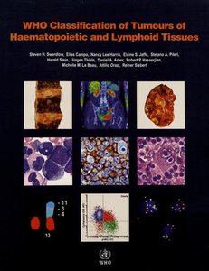 WHO Classification of Tumours of Haematopoietic and Lymphoid Tissue 2017. Revised 4th edition.