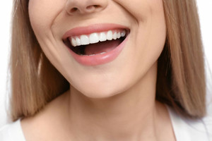 Хочу красивые зубы, вставить импланты что б могла улыбаться