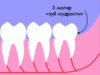 Зуб мудрости чтобы прорезался