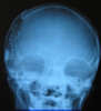 Рентгенограмма моего черепа в декоративной рамке