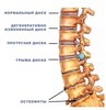 чтобы спина починилась и перестала болеть