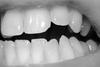 Белые зубки