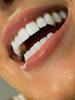 белоснежные зубки