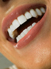 ровные белые зубы