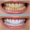 Crest 3D White Whitestrips - Отбеливающие полоски для зубов.