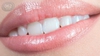 Белоснежная улыбка / Отбеливание зубов