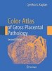 Atlas of gross placental pathology