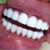 Ровные белые зубы