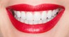 Ровные красивые белые зубы