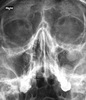 Otolaryngologist Snapshot