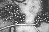 Hepatitis E Virus Antigens