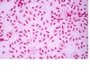Haemophilus influenza Antigens