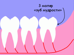 Зуб мудрости чтобы прорезался