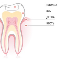 полечить зубы