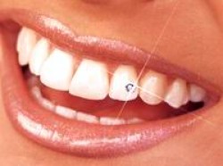 зубы красивые