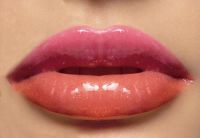surgilips/restyline