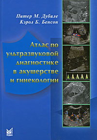 Питер М. Дубиле, Кэрол Б. Бенсон  Атлас по ультразвуковой диагностике в акушерстве и гинекологии