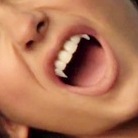 Отбелить зубы